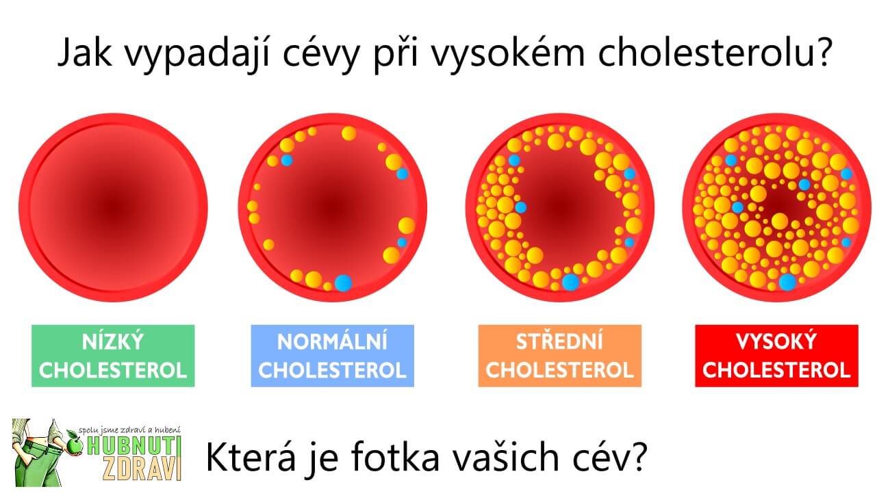 Máte vysoký cholesterol? Napravte jej stravou – tyto potraviny pomůžou!